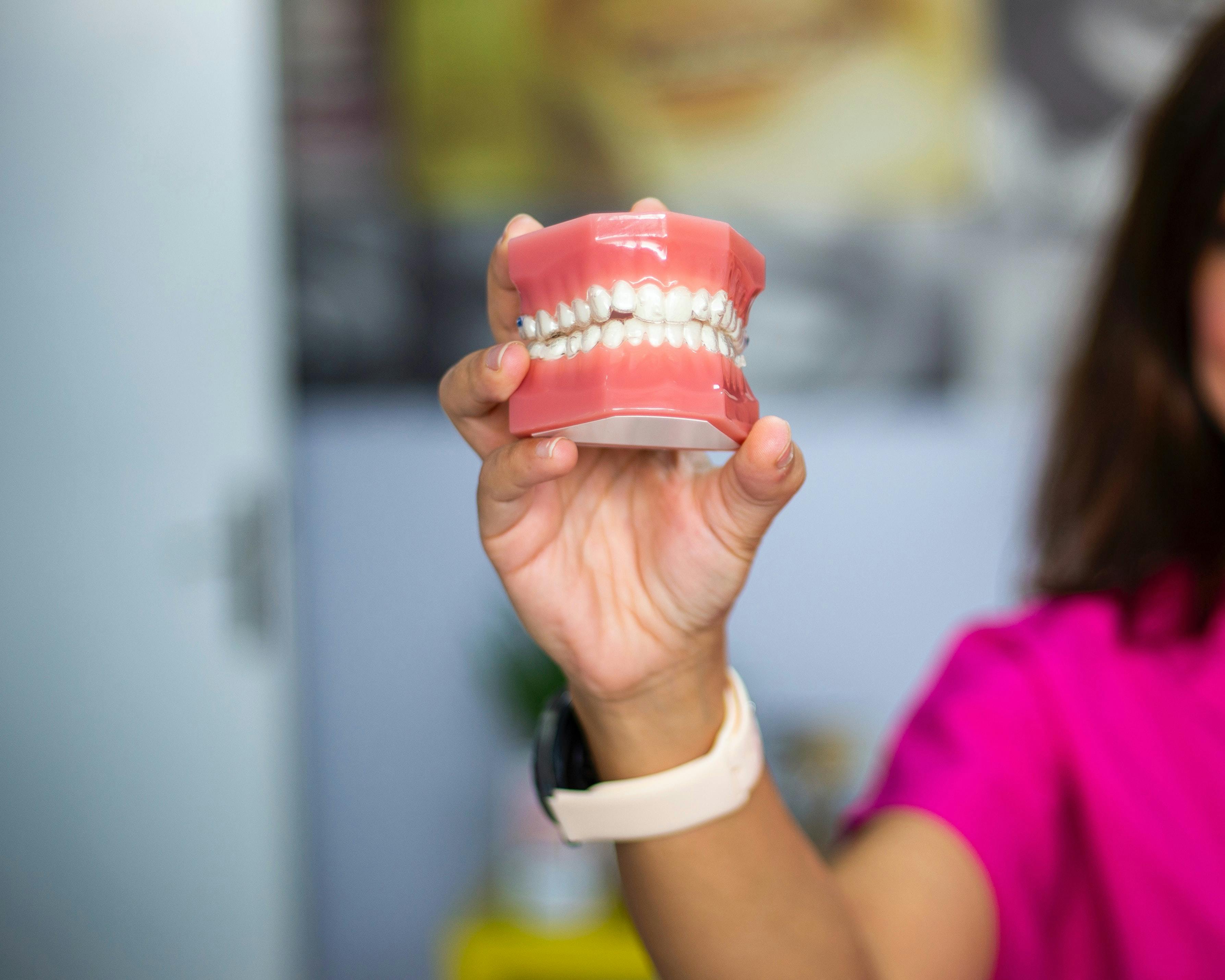 Prótese dentária com acabamento estético natural